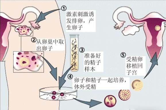借卵试管代怀安全吗_借卵试管代怀安全吗,需要了解的关键信息